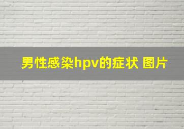 男性感染hpv的症状 图片